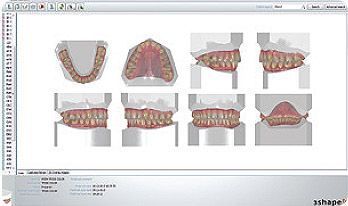 Фото Интраоральный 3D Сканер 3Shape TRIOS 3 Basic Pod