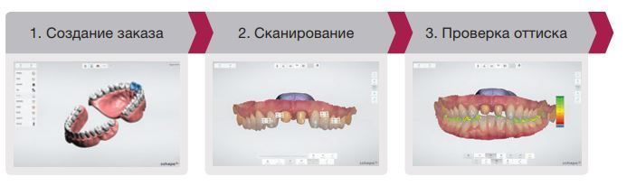 Фото Интраоральный 3D Сканер 3Shape TRIOS 3 Basic Pod